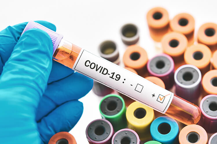 COVID-19 News
